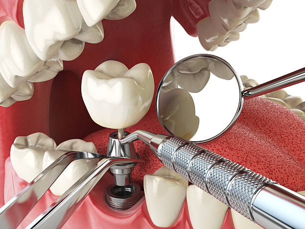 Best Pediatric Emergency Dentist in Bonny Doon, CA